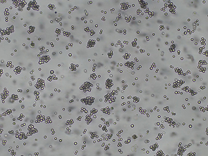 Brightfield micrograph of Akata-EGFP Reporter Cell Line, showing suspension growth.