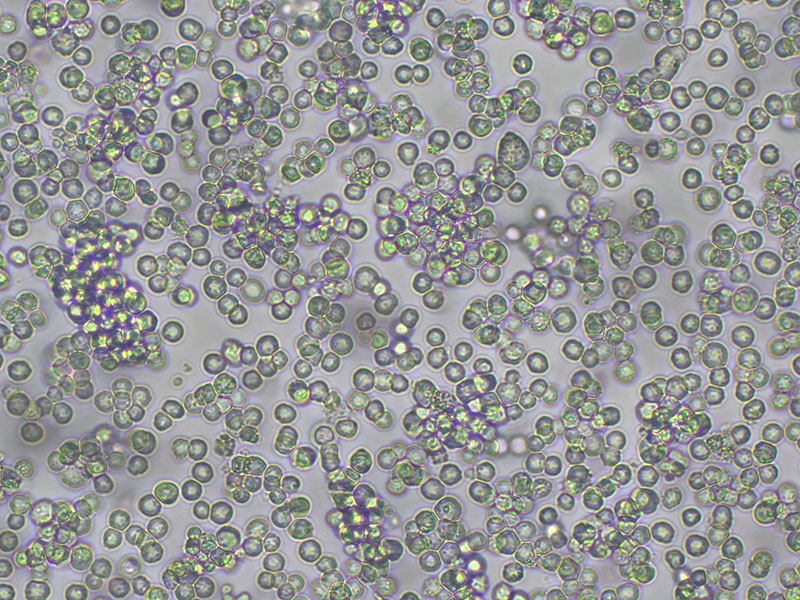 Brightfield micrograph of H22 Luciferase Reporter Cell Line, showing suspension growth, 10X magnification.