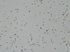 Brightfield micrograph of HT-29 GFP and Luciferase Reporter Cell Line, adherent growth, 4X mag.