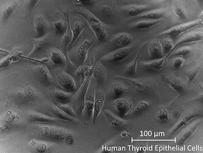 Brightfield micrograph of Human Thyroid Epithelial Cells, showing adherent growth.