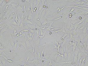 Brightfield micrograph of Immortalized Human Umbilical Cord-Derived Mesenchymal Stem Cells, showing adherent growth, 10X magnification.