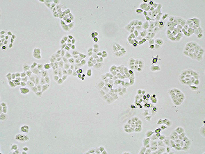 Brightfield micrograph of OVCAR-8 Luciferase Reporter Cell Line, showing adherent growth, 4X magnification.