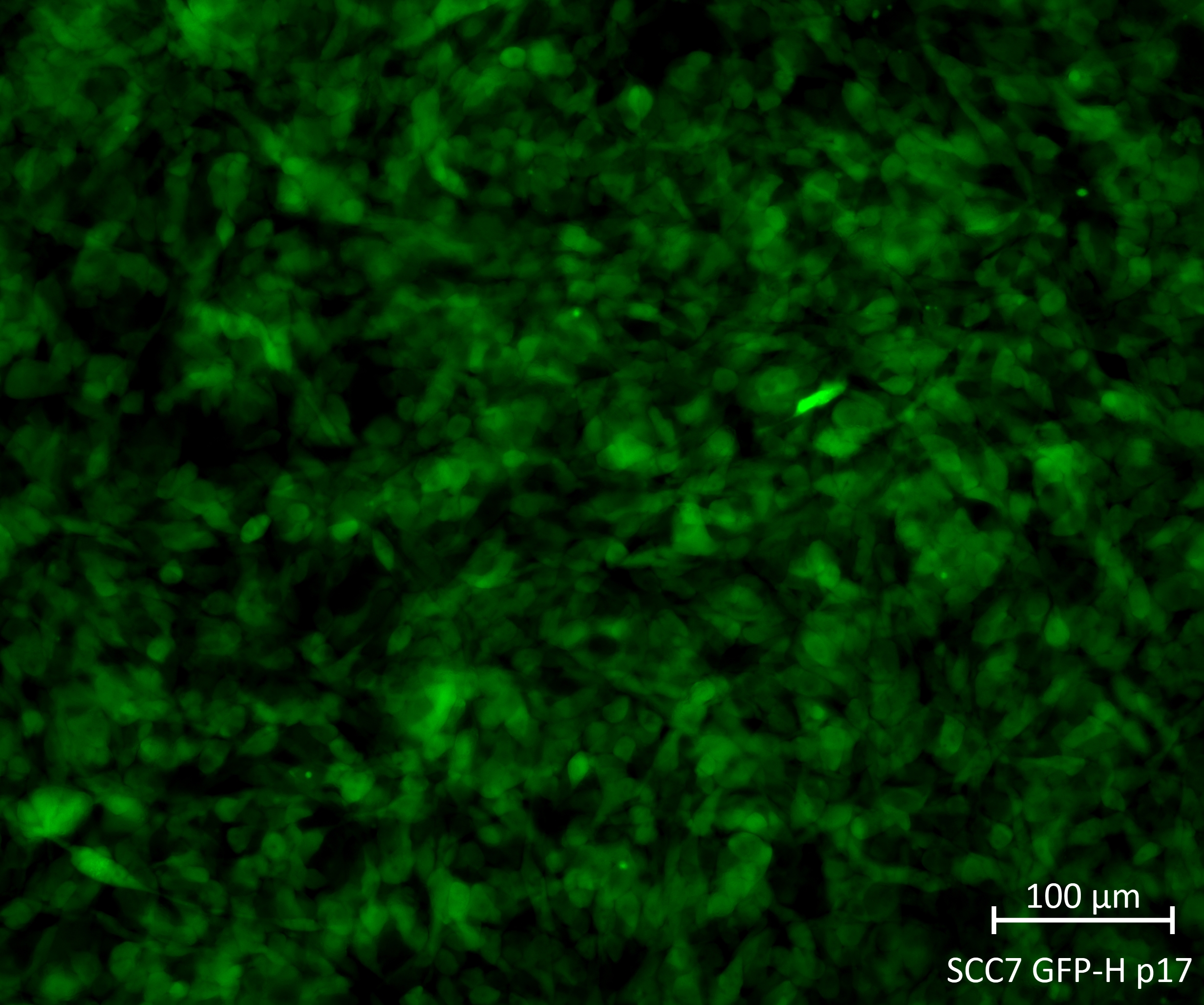 Fluorescence microscopy image of SCC7 GFP Reporter Cell Line, showing green fluorescence.