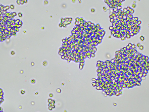 Brightfield micrograph of SHP-77 GFP and Luciferase Reporter Cell Line, showing suspension growth, 10X magnification.