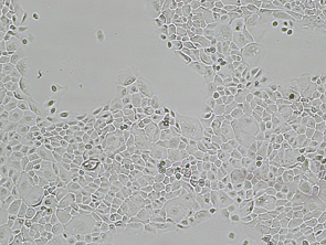 Brightfield micrograph of SW1990 GFP and Luciferase Reporter Cell Line, showing adherent growth, 4X magnification.