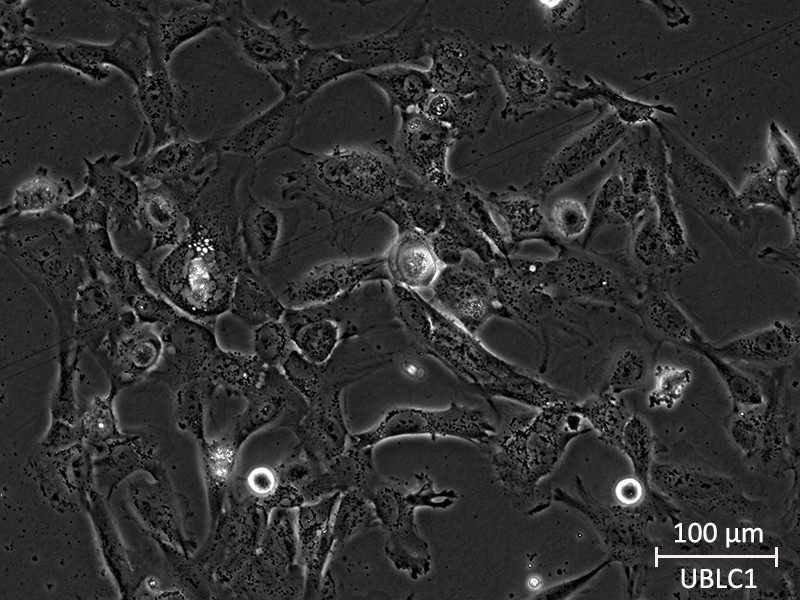 Brightfield micrograph of U-BLC1, showing adherent growth, 20X magnification.