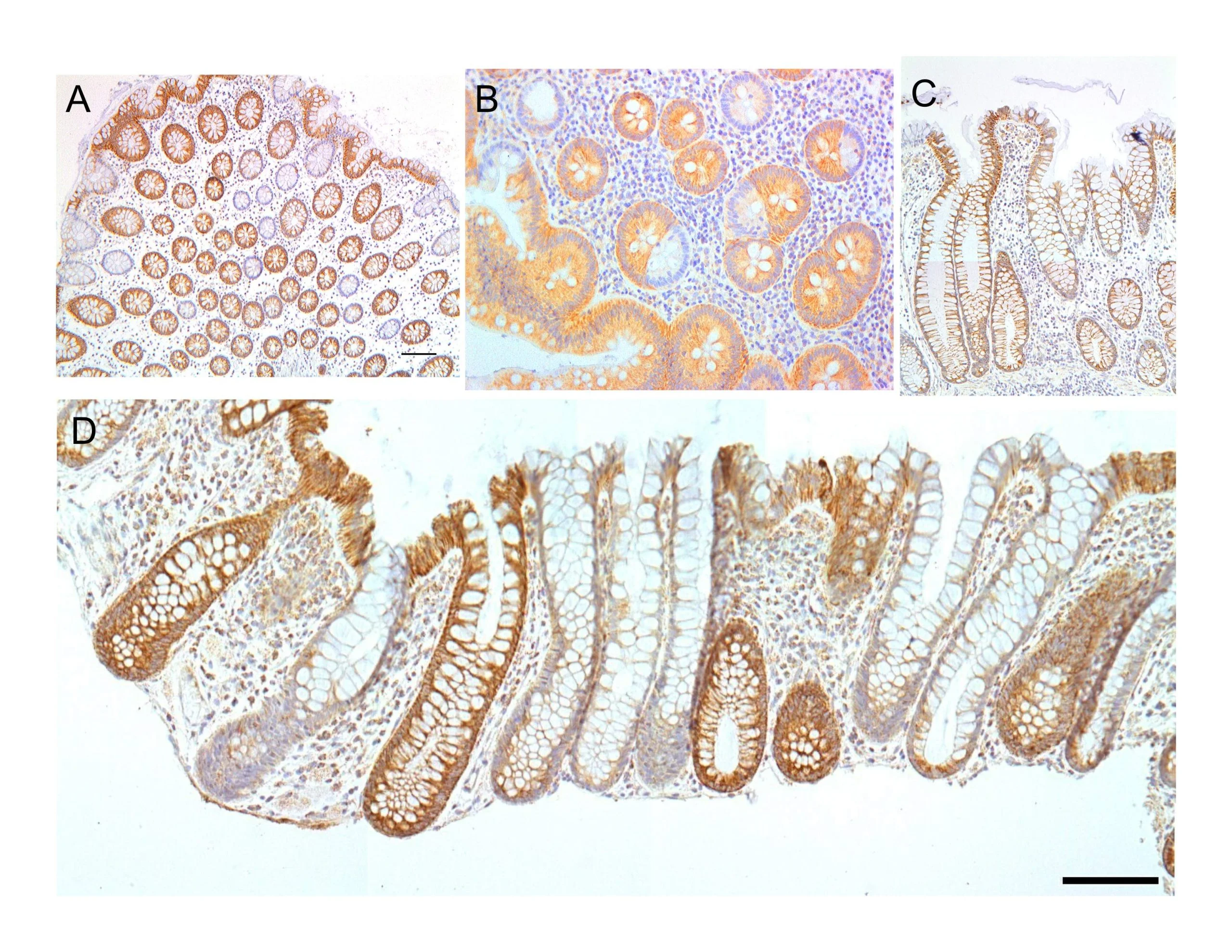 Human Colonic Epithelial Cells and Colon Diseases