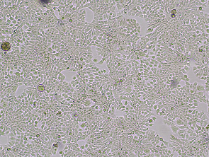 HCC1428 Luciferase Reporter Cell Line
