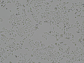 Brightfield micrograph of JIMT-1 Luciferase Reporter Cell Line, showing adherent growth.