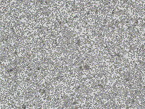MM.1S Luciferase/GFP Reporter Cell Line
