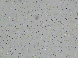 Brightfield micrograph of NALM-6 Luciferase Reporter Cell Line, showing suspension growth, 4X magnification.