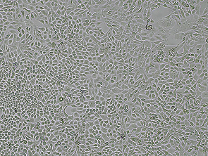 Brightfield micrograph of NCI-H322 Luciferase Reporter Cell Line, showing adherent growth.