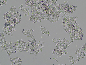 Brightfield micrograph of NCI-H446 Luciferase Reporter Cell Line, showing adherent growth.