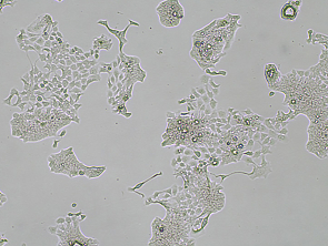 Brightfield micrograph of NCI-N87 Luciferase Reporter Cell Line, showing adherent growth, 4X magnification.
