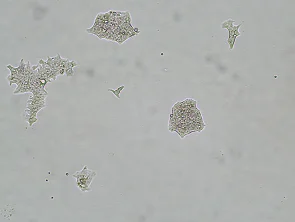Brightfield micrograph of NCI-N87 Luciferase Reporter Cell Line, showing adherent growth, 4X magnification.