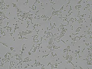 Brightfield micrograph of NCI-N87 Luciferase Reporter Cell Line, showing adherent growth.