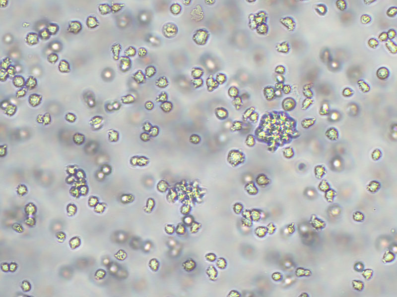 Brightfield micrograph of OCI-Aml-3 Luciferase Reporter Cell Line, showing suspension growth, 10X magnification.