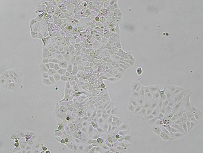 Brightfield micrograph of PLC/PRF/5 Luciferase/GFP Reporter Cell Line, showing adherent growth, 4X magnification.