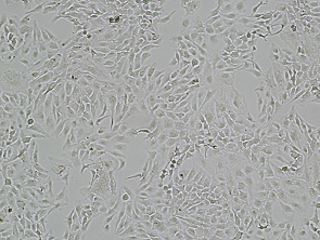Brightfield micrograph of SK-OV-3-EGFP-LUC, adherent growth, 4X mag.