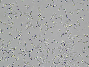 Brightfield micrograph of SK-OV-3 Luciferase/GFP Reporter Cell Line, adherent growth, 4X mag.