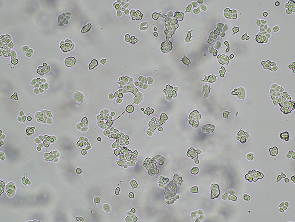 Brightfield micrograph of ZR-75-1 Luciferase Reporter Cell Line, showing adherent growth, 4X magnification.
