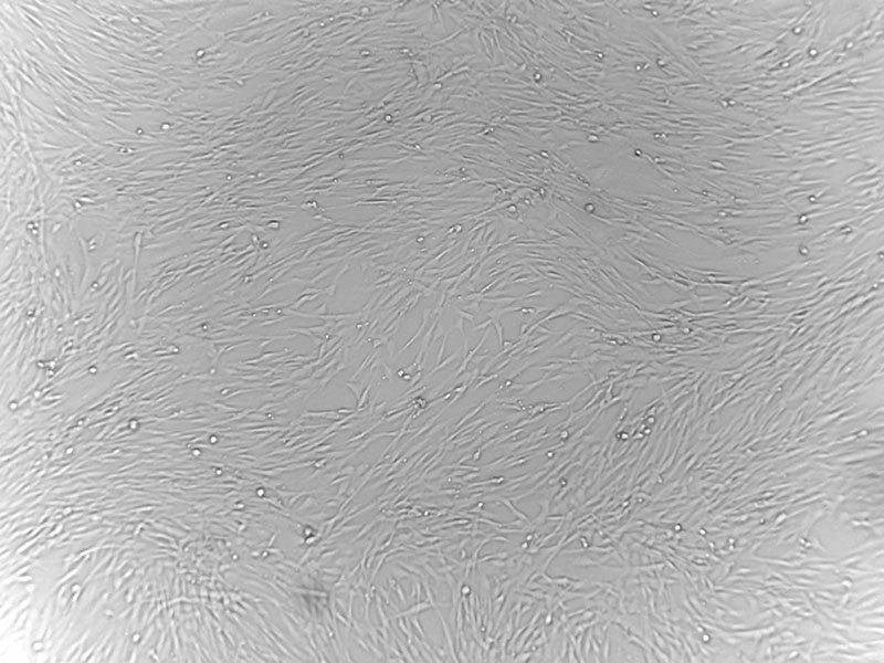 Brightfield micrograph of Human Orbital Fibroblasts, showing adherent growth, 4X magnification.