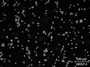 Brightfield micrograph of MOLP-2, showing suspension growth, 10X magnification.