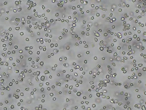 Brightfield micrograph of OCI-AML3, showing suspension growth.