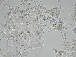 Brightfield micrograph of 4T1 mCherry Reporter Cell Line, showing adherent growth, 4X magnification.