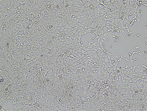 Brightfield micrograph of EGFP Reporter Cell Line-4T1, adherent growth, 4X mag.