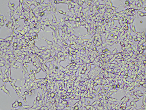 Brightfield micrograph of LNCaP-Clone-FGC-EGFP, adherent growth, 10X mag.