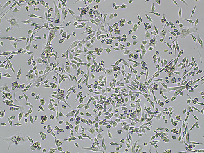 Brightfield micrograph of MDA-MB-231-EGFP, adherent growth, 4X mag.