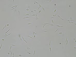 Brightfield micrograph of SASO-2 EGFP, adherent growth, 4X mag.