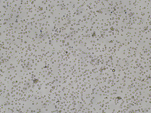 Brightfield micrograph of SU-DHL-4-LUC, suspension growth, 4X mag.