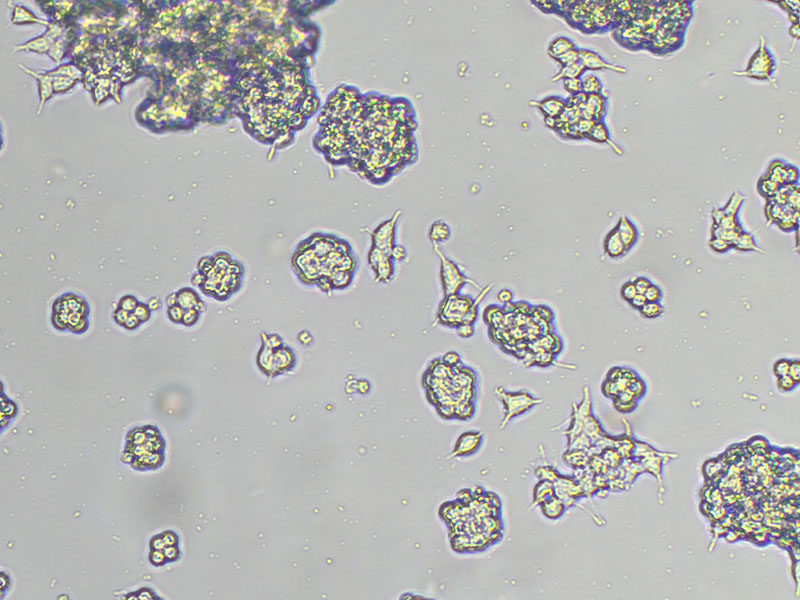 Brightfield micrograph of CAL-148, showing adherent and suspension growth, 10X magnification.