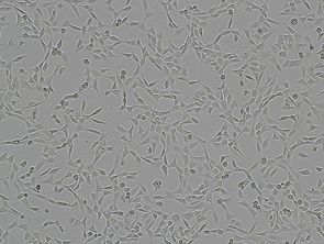 Brightfield micrograph of HT-22, showing adherent growth.