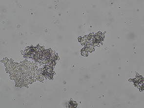 Brightfield micrograph of NCI-H660, showing floating aggregates of rounded cells and some attached cells.