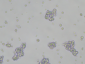 Brightfield micrograph of NCI-H660, adherent growth, 10X mag.