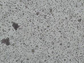 Brightfield micrograph of SKM1, showing suspension growth.