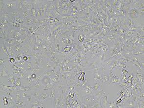 Brightfield micrograph of HEK-293-ACVR2B-KO, adherent growth, 4X mag.