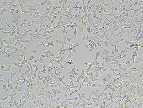 Brightfield micrograph of FAP HT-1080 Cell Line, showing adherent growth, 4X magnification.