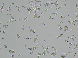 Brightfield micrograph of FcRn (FCGRT & B2M), GFP Tag Over-expressing (HEK-293), adherent growth, 4X mag.