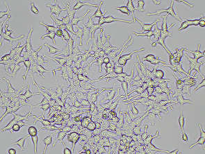 Brightfield micrograph of FcRn-FCGRT-B2M-GFP-Over-expressing-HEK-293, adherent growth, 10X mag.