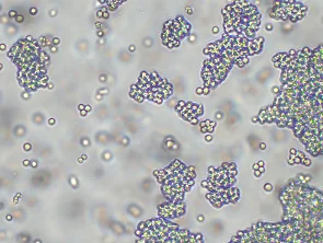 Brightfield micrograph of Human NKp46 (Luc) Reporter Cell Line , showing suspension growth, 10X magnification.