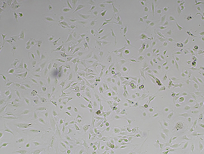 Brightfield micrograph of Immortalized Human Coronary Artery Endothelial Cells, adherent growth, 4X mag.