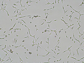 Brightfield micrograph of Immortalized-Human-Breast-Tumor-Associated-Fibroblasts, adherent growth, 4X mag.