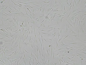Brightfield micrograph of Immortalized Human Orbital Fibroblasts, adherent growth, 4X mag.