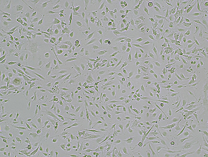 Brightfield micrograph of Immortalized Human Type II Alveolar Epithelial Cells, adherent growth, 4X mag.