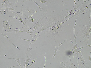 Brightfield micrograph of Immortalized White Preadipocytes-hTERT, showing adherent growth, 4X magnification.