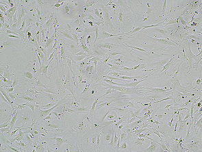 Brightfield micrograph of Immortalized Mouse Hepatic Stellate Cells – SV40, showing adherent growth, 4X magnification.
